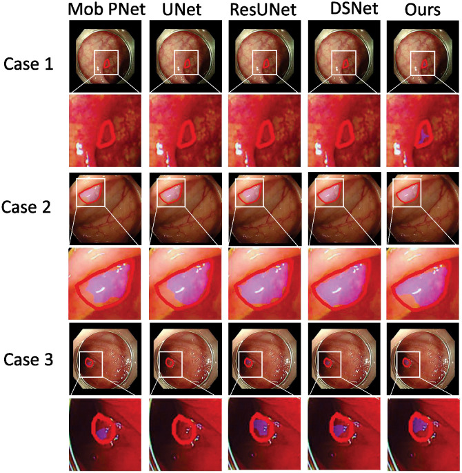 Figure 44
