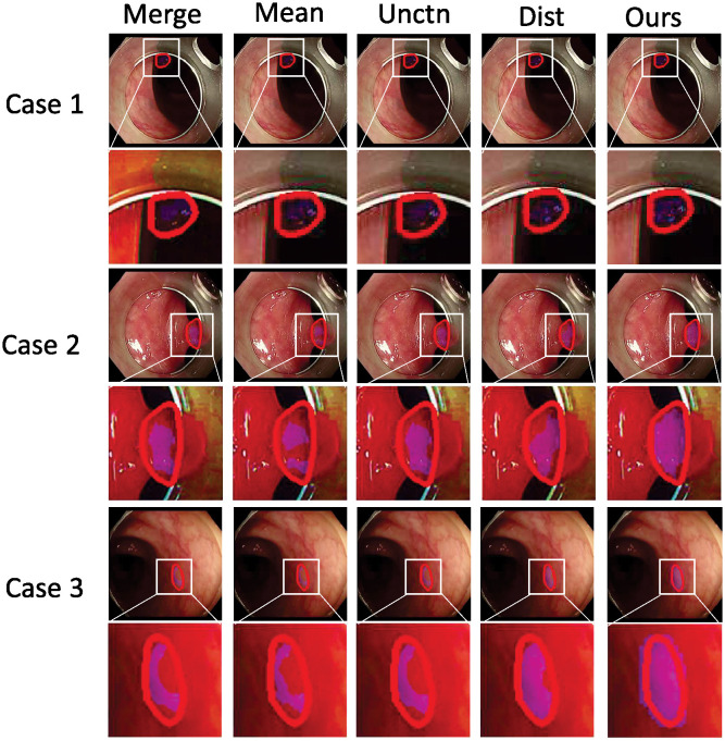 Figure 46