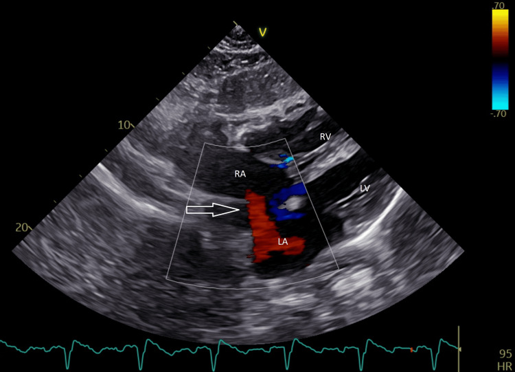 Figure 4