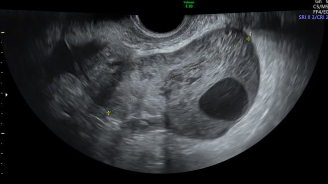 Figure 6