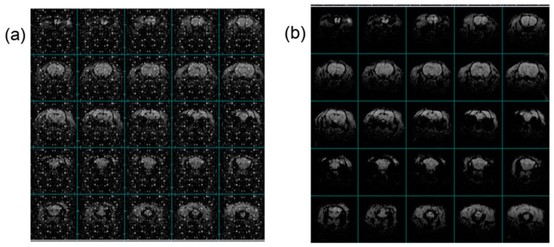Figure 11