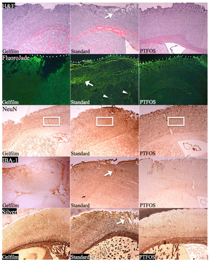Figure 14