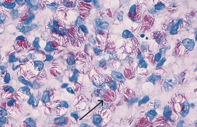 Figure 9