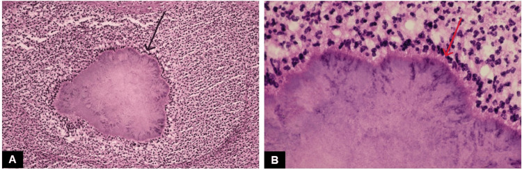 Figure 11
