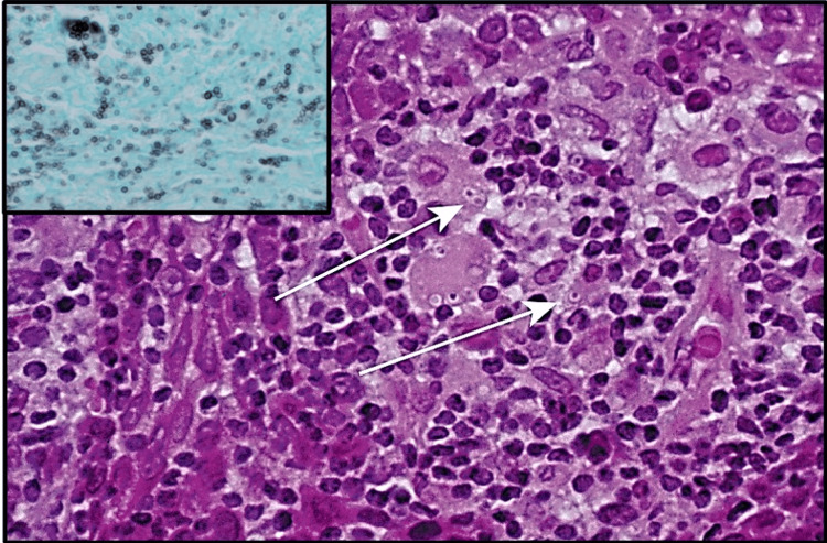 Figure 13