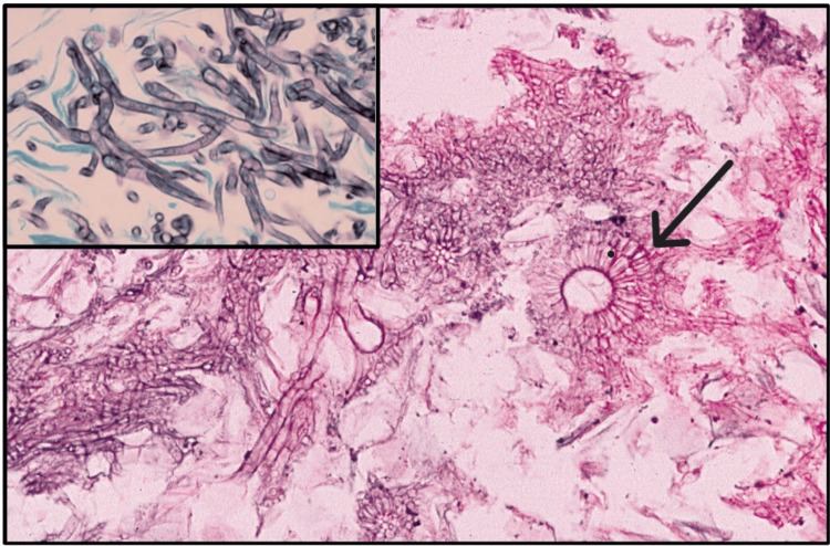 Figure 14