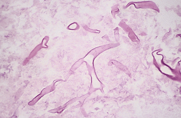 Figure 15