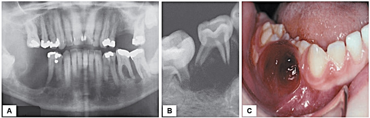 Figure 17