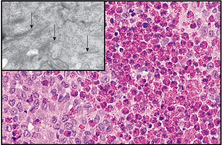 Figure 18