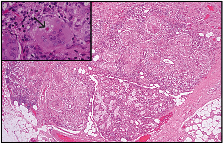 Figure 20