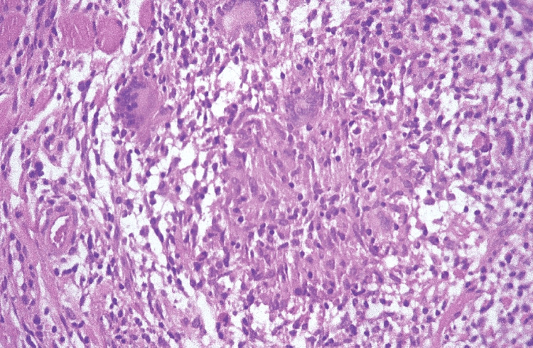 Figure 22