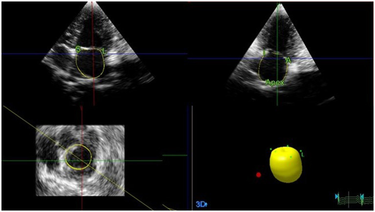 Figure 4