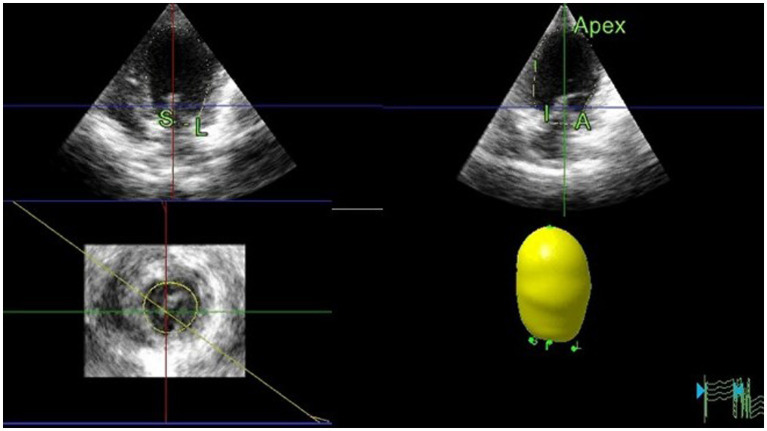 Figure 5
