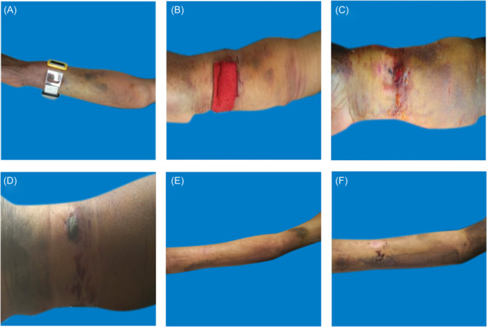 Figure 7