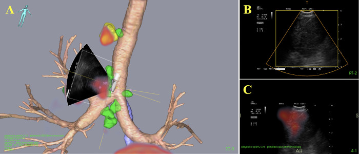 Fig 4