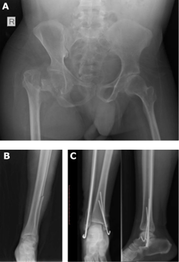 Figure 2