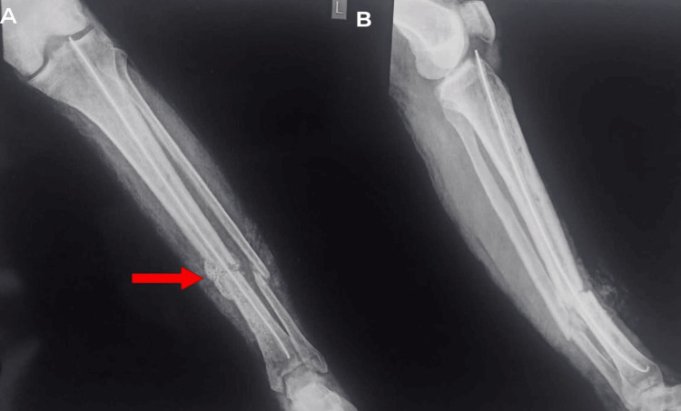 Figure 9