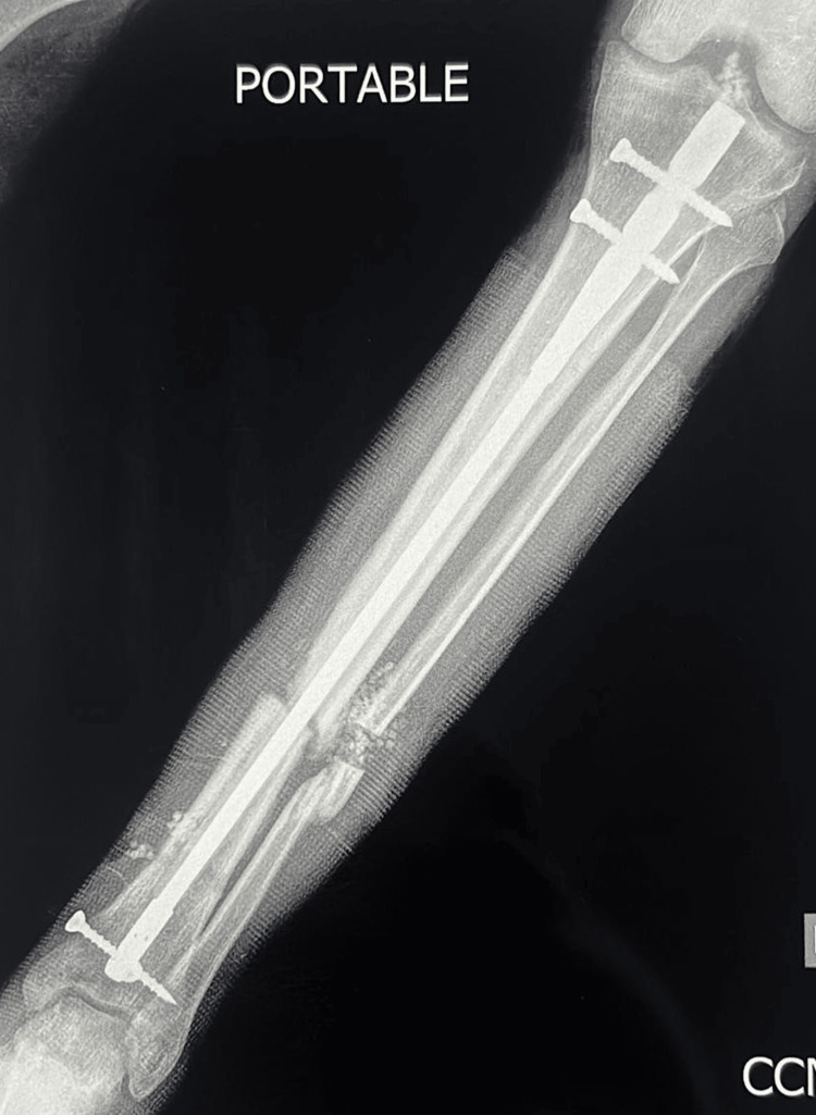 Figure 11