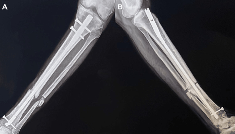 Figure 13