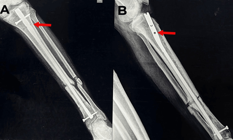 Figure 14