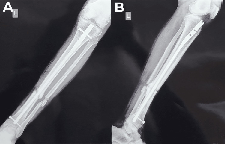 Figure 15