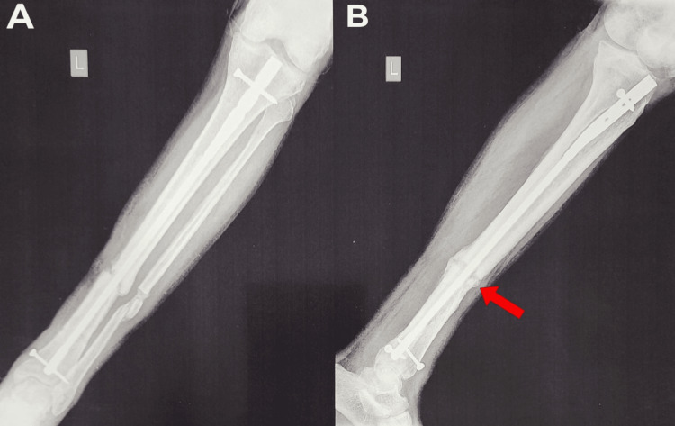 Figure 16