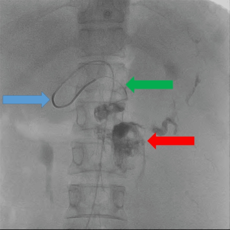 Figure 6