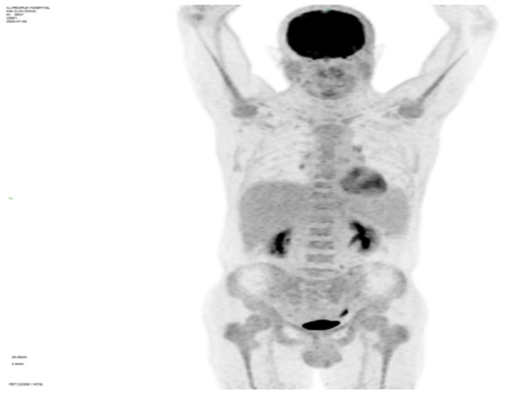 Figure 2