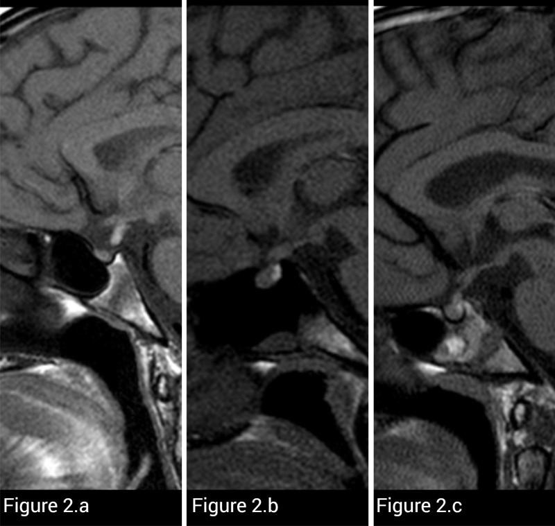 Figure 2