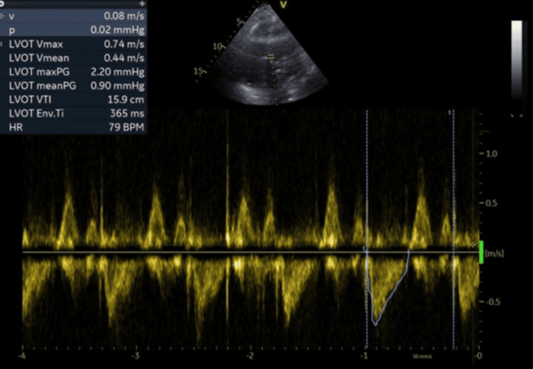 Figure 9