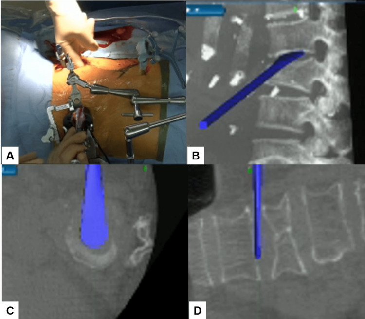 Figure 4