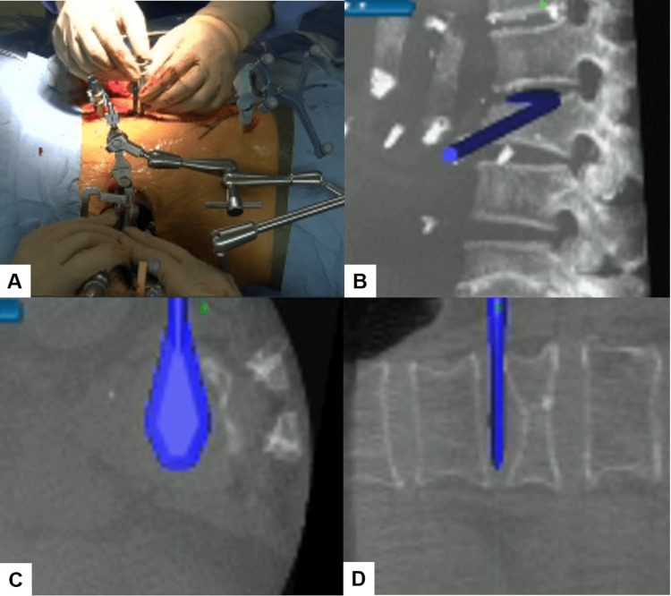 Figure 5