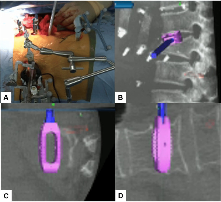 Figure 6