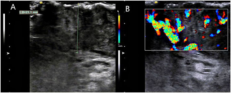 Figure 1