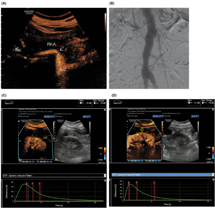 FIGURE 3