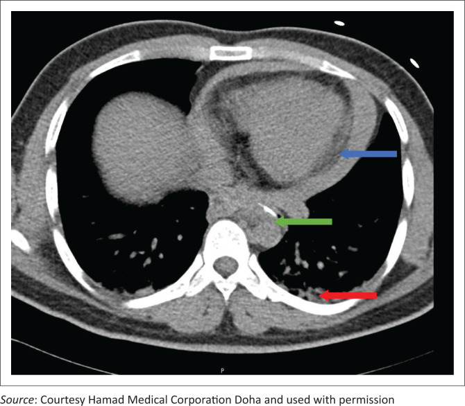 FIGURE 2