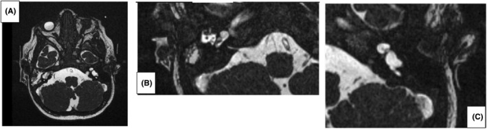 FIGURE 2