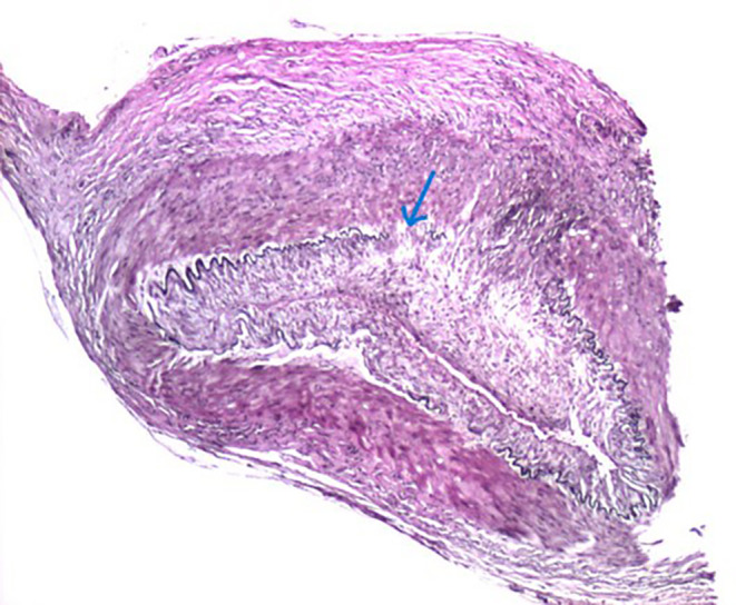 FIGURE 3