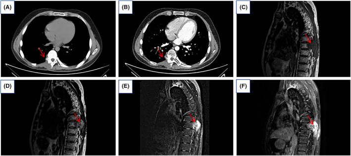 FIGURE 4
