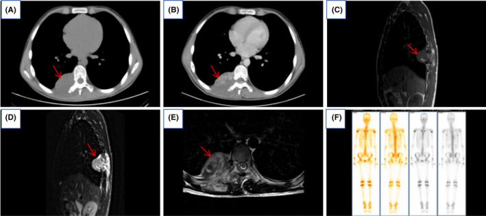 FIGURE 1