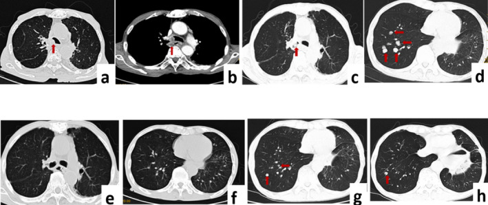 FIGURE 1