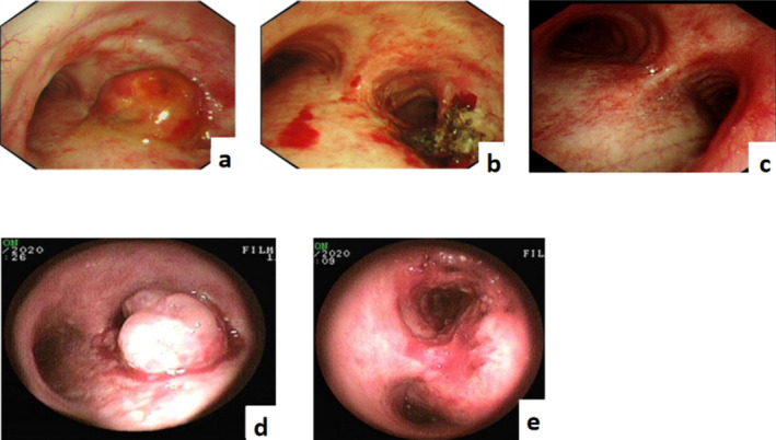 FIGURE 2