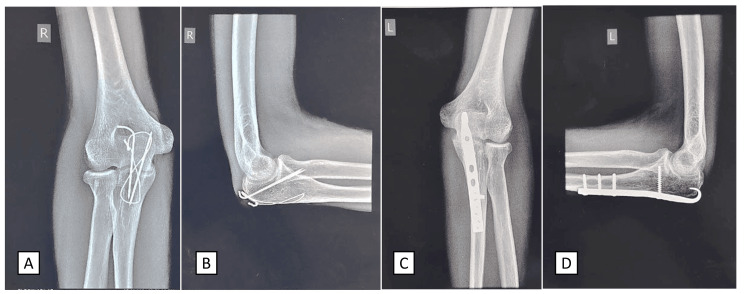 Figure 5