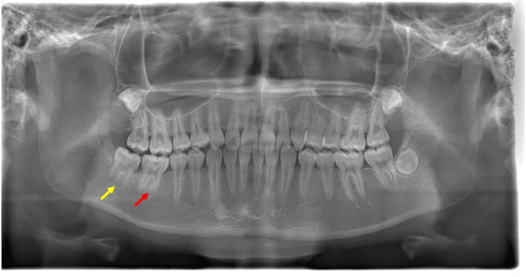 Figure 6