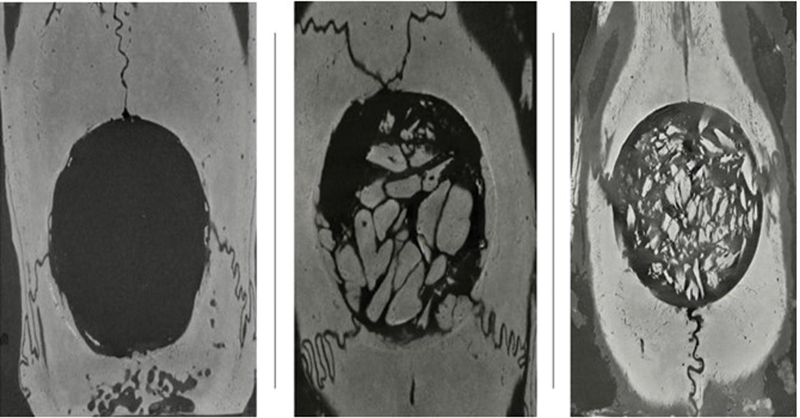 Figure 17