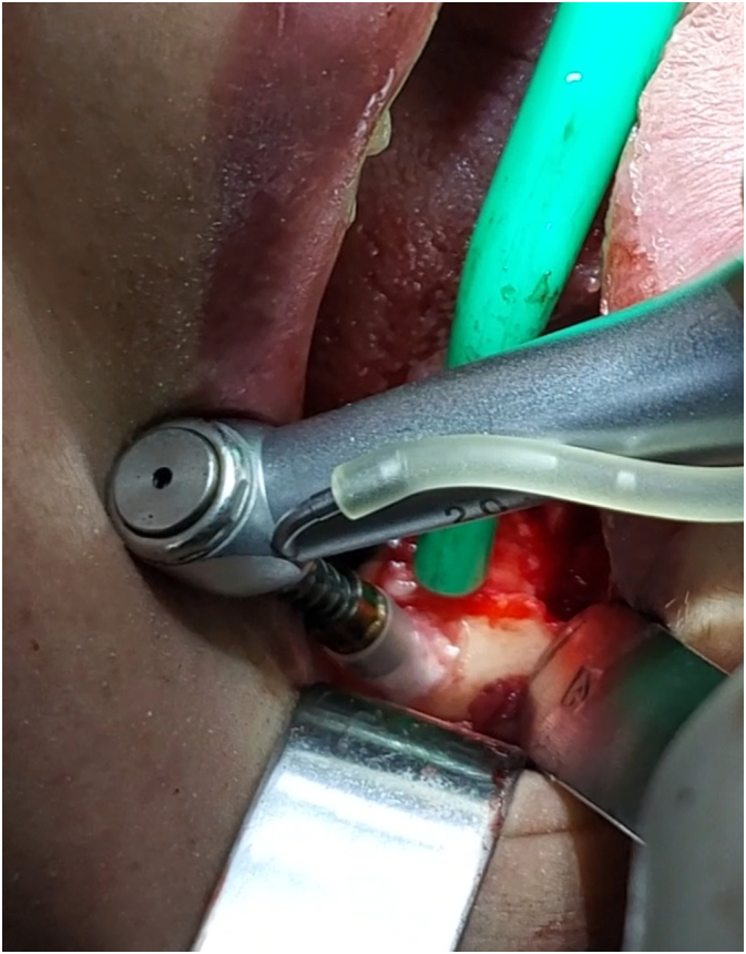 Figure 10