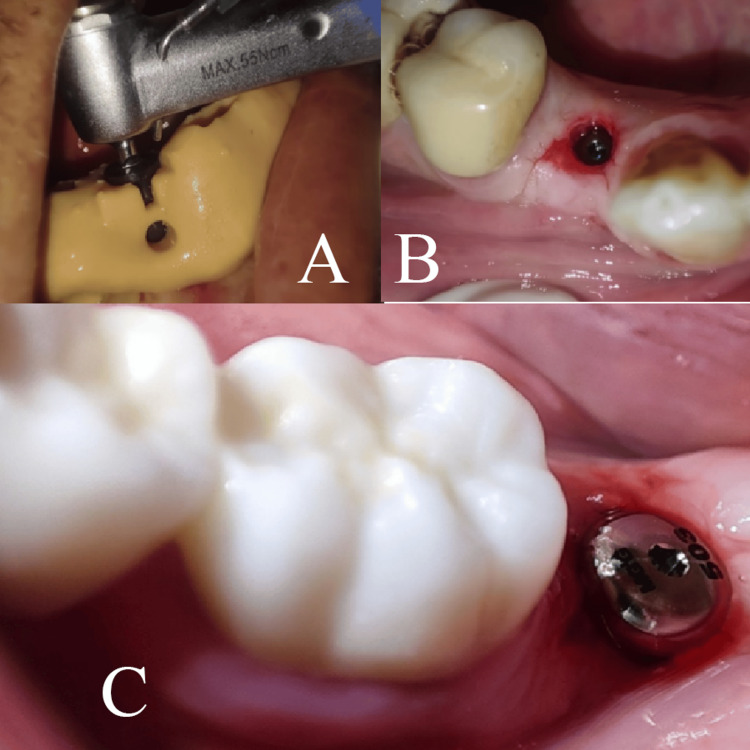 Figure 6