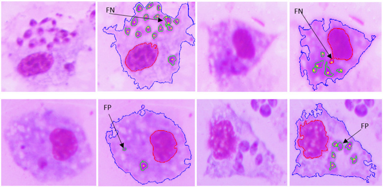 Figure 11