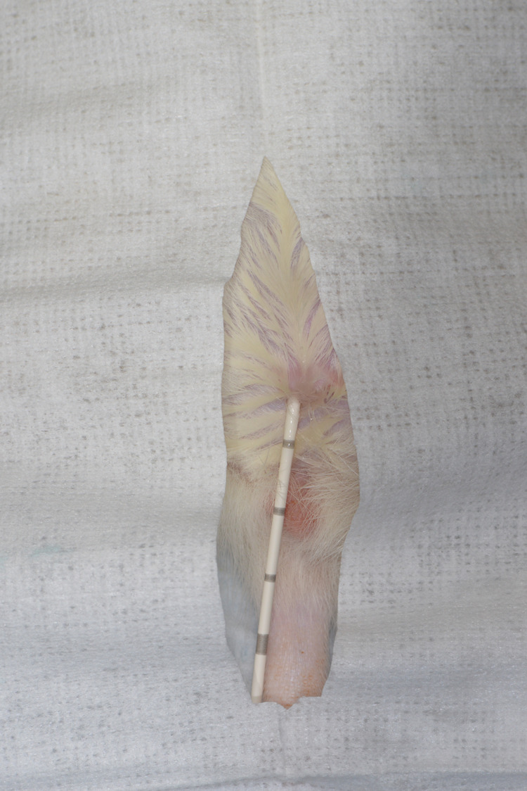 Fig. 2