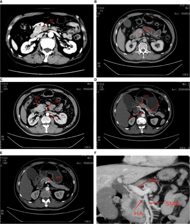 Figure 1